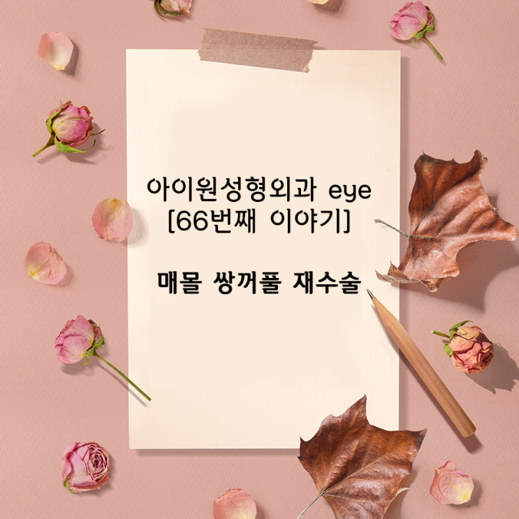  [아이원성형외과 eye] 쌍꺼풀 재수술을 하면 기존 실은 어떻게 하나요?