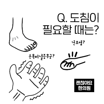 도침치료가 필요한 상황 질환. 도침은 언제 맞나요? 도침치료가 필요한 상황 질환. 도침은 언제 맞나요?