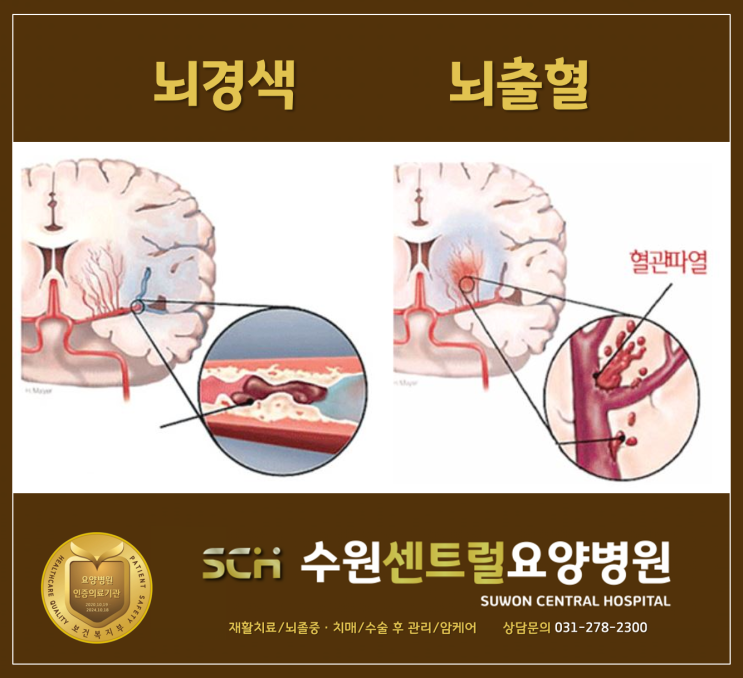  수원, 의왕, 안양, 안산, 화성, 동탄 재활요양병원 : 뇌출혈, 뇌경색 체계적인 재활