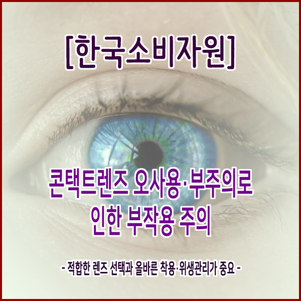  [한국소비자원] 콘택트렌즈 오사용·부주의로 인한 부작용 주의