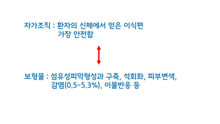  자가조직 코성형만이 무보형물 코성형, 자가조직의 A부터 Z까지