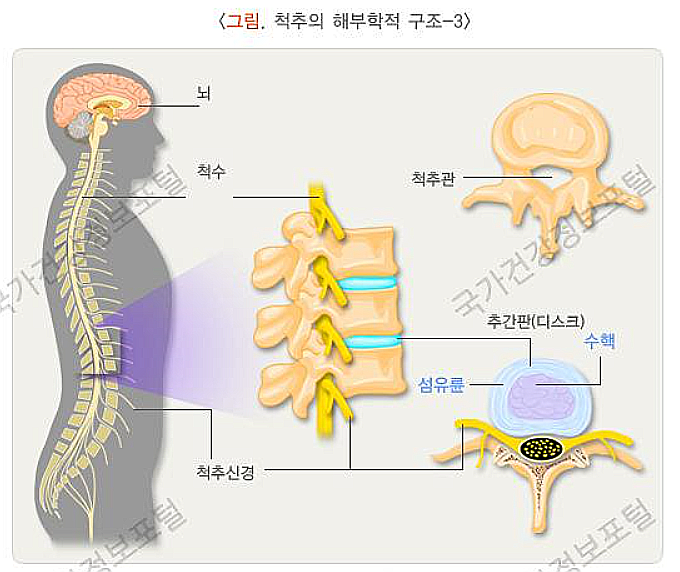 요통 발생 원인과 연관 증상, 치료법 자세히 알아보기 : 네이버 블로그