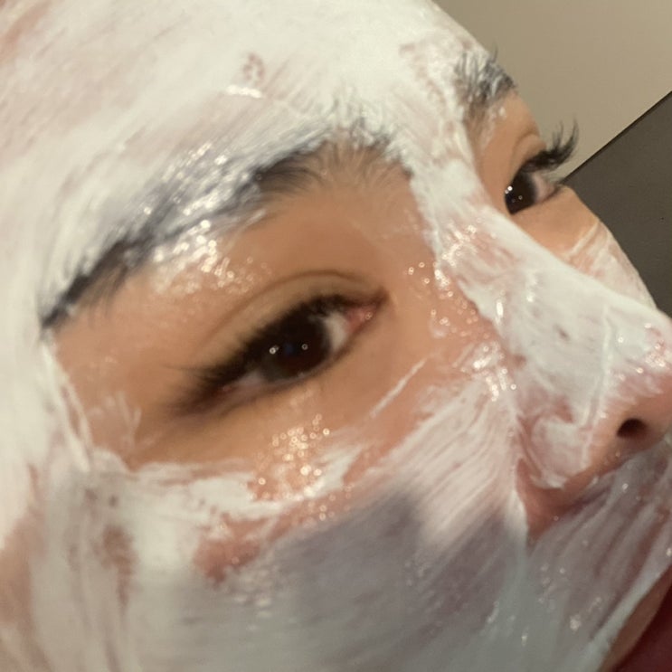 대구 칠곡 문제성 피부 전문 아이미 스킨케어에서 홍조 관리받고 왔어요! 대구 칠곡 문제성 피부 전문 아이미 스킨케어에서 홍조 관리받고 왔어요!