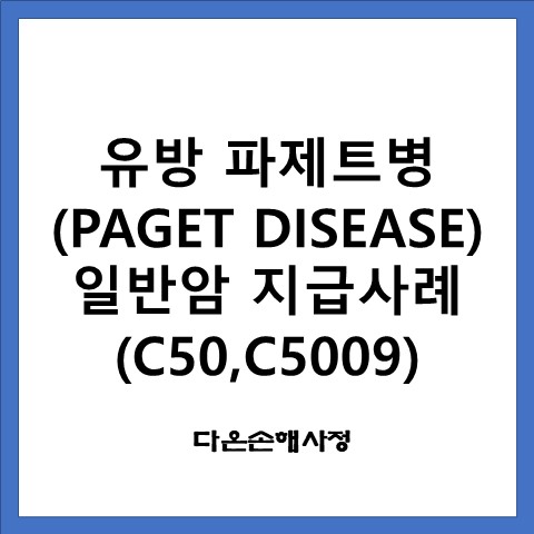 유방 파제트병(PAGET DISEASE) 일반암 지급사례(C50,C5009)