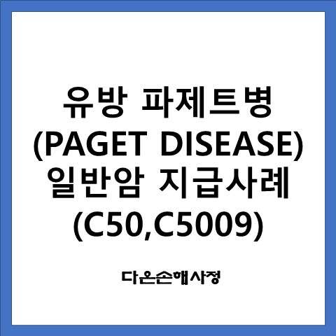  유방 파제트병(PAGET DISEASE) 일반암 지급사례(C50,C5009)