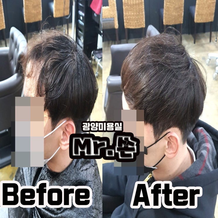  탈모커버 이정도면 대박인데 . . . ! ! !