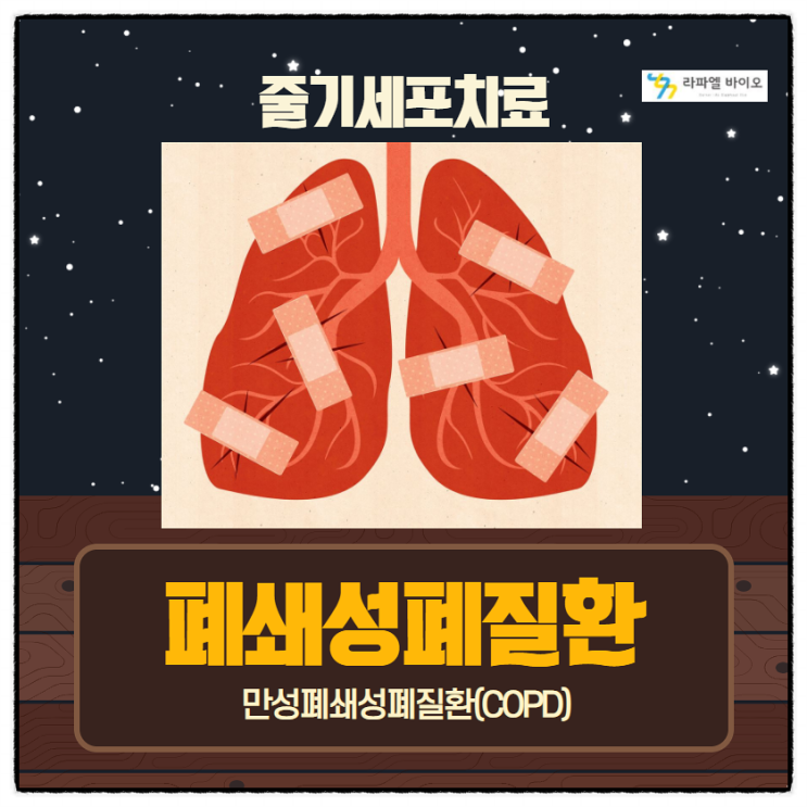  폐쇄성폐질환(COPD)과 줄기세포치료의 중요성