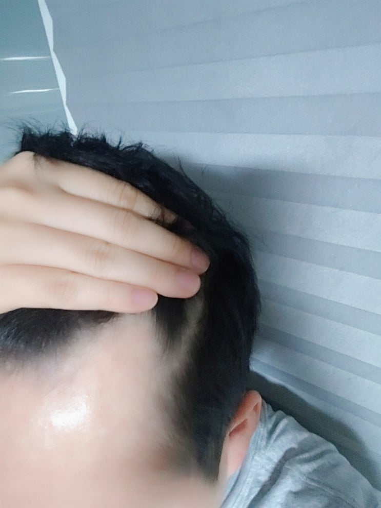  엠자이마 구렛나루 커버전후 차이가 보입니다