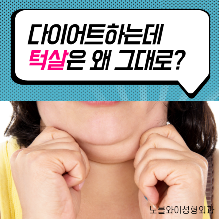  턱살제거 이중턱수술로 말끔