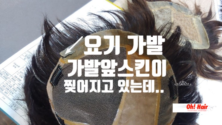  가발앞스킨 찢어짐...수선 좋아! 아직 더 쓸수 있다구~