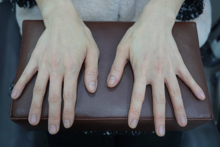 피부과전문의가 설명하는 손등 필러 (손등 주름, 마른 손이 신경 쓰일 때)