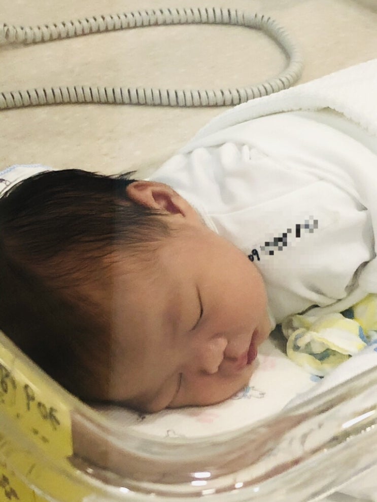 신생아 생후 30일차 배냇머리 빠지는중이에요