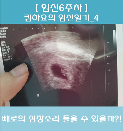  [임신6주차_임신일기] 임신6주차 심장소리 들을 수 있을까?