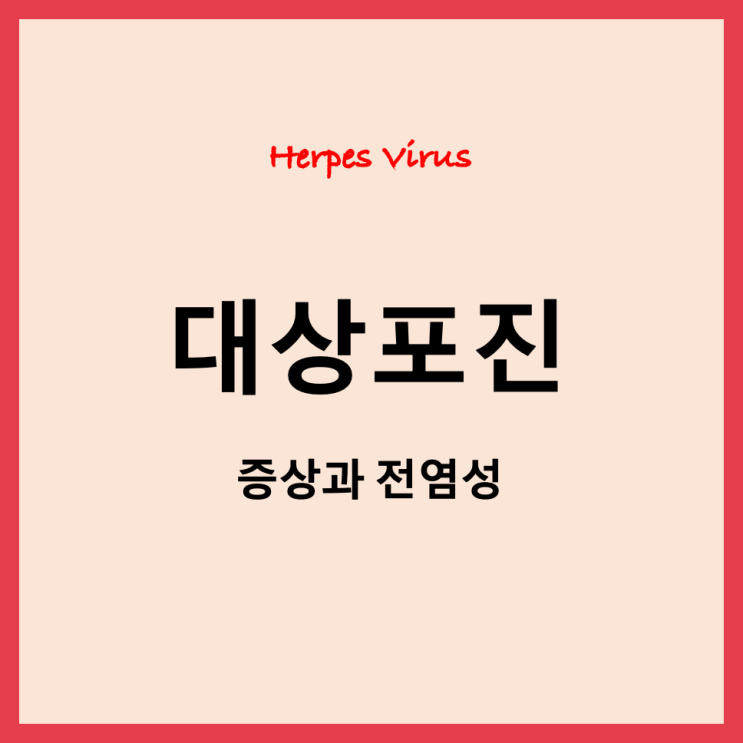  대상포진 초기증상과 전염성, 대표적인 입술포진(구순포진)