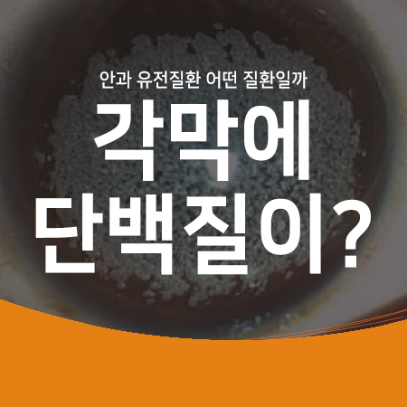 각막 상처로 각막에 단백질이 쌓이는 안과 유전병? 나는 누구일까요?