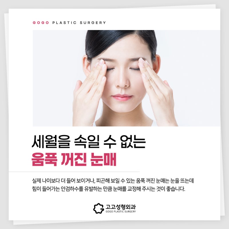 눈지방이식은 가격, 비용보다 맞춤개선이 더 중요