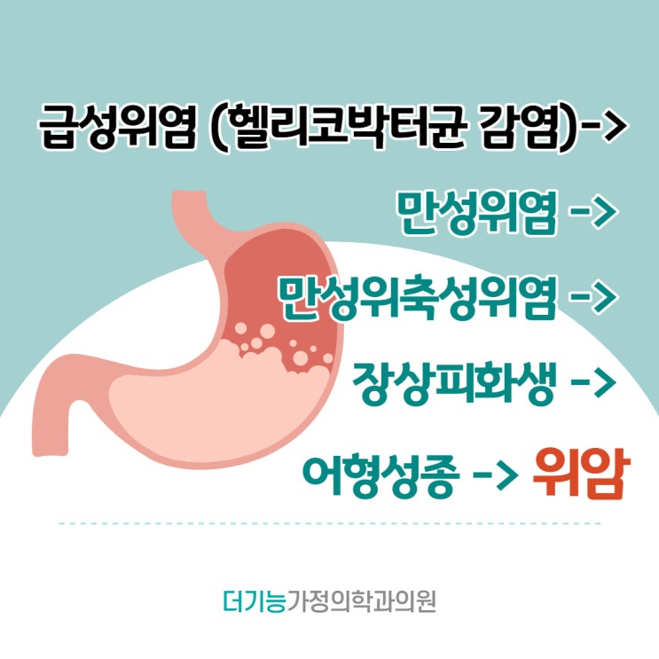  식후명치통증, 설마 내가 위암이려고?