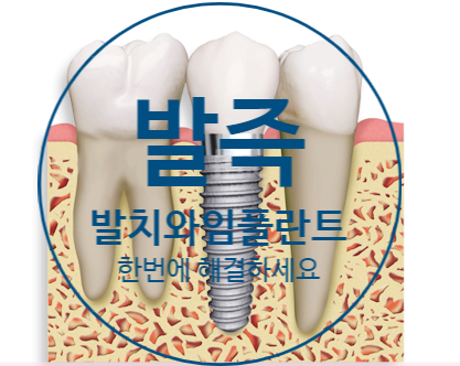 당감동치과 발치와 임플란트를 동시에