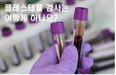  콜레스테롤 검사는 어떻게 하나요?