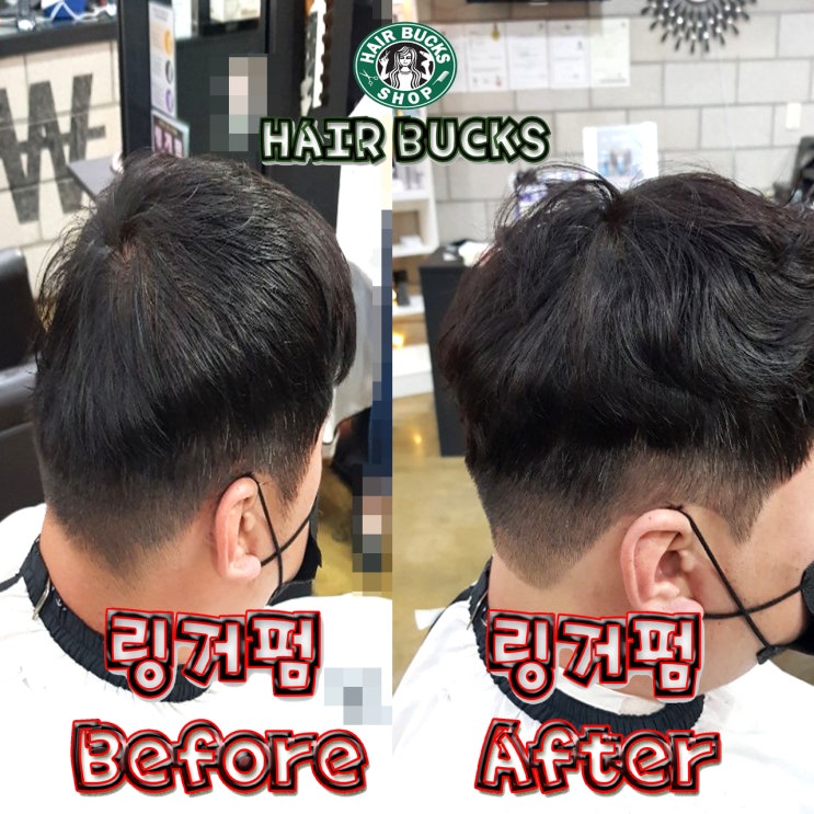 없던 뒷통수도 만들어주는 마법의 링거펌 ~!