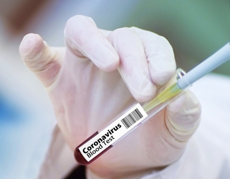국내 코로나19 백신 4,400만명분 확보, 내년 상반기 접종 예상.