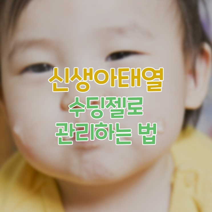  신생아태열 수딩젤로 관리하는 법