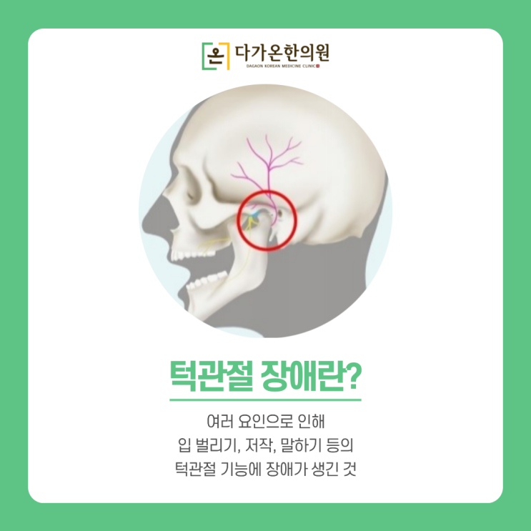 까치산역 야간진료 한의원 턱관절이 아플때, 턱관절장애