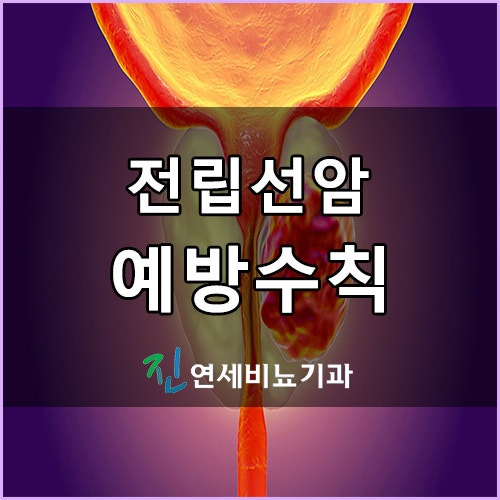부산비뇨기과에서 전립선 건강 챙기기