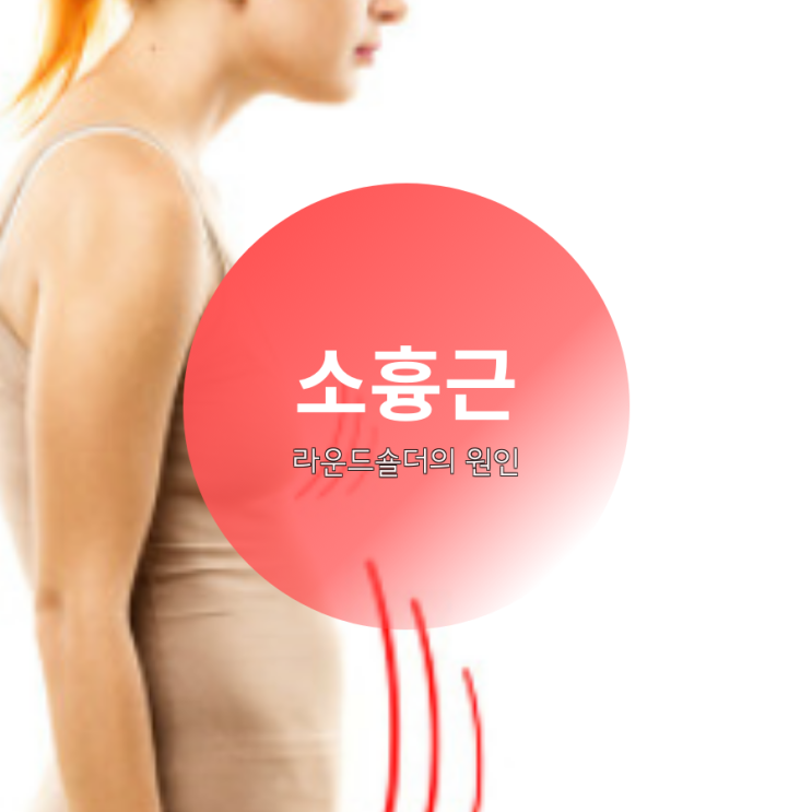  소흉근 라운드숄더(둥근어깨)의 원인 스트레칭 관리법 알려드립니다