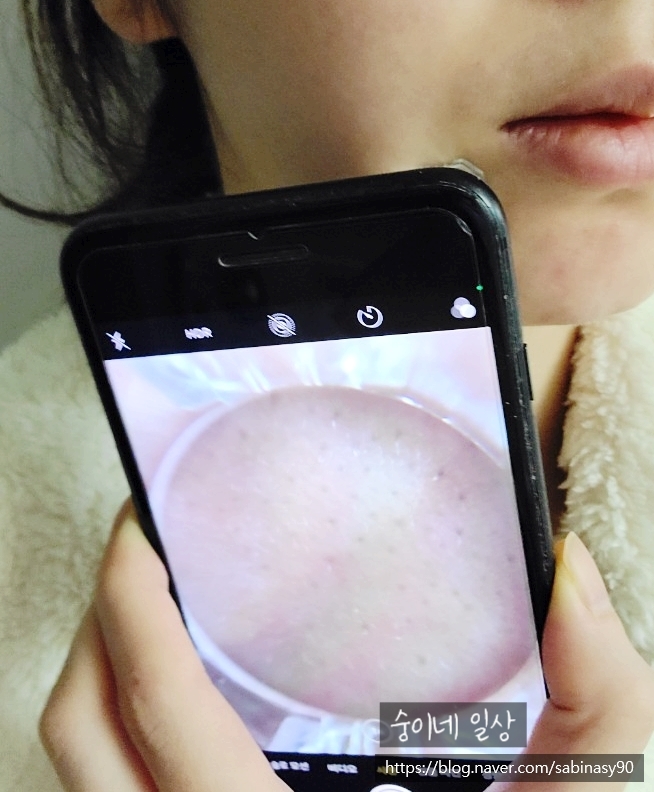  내 피부 맞춤형 관리하는 법? 스킨핏 프로그램 해결