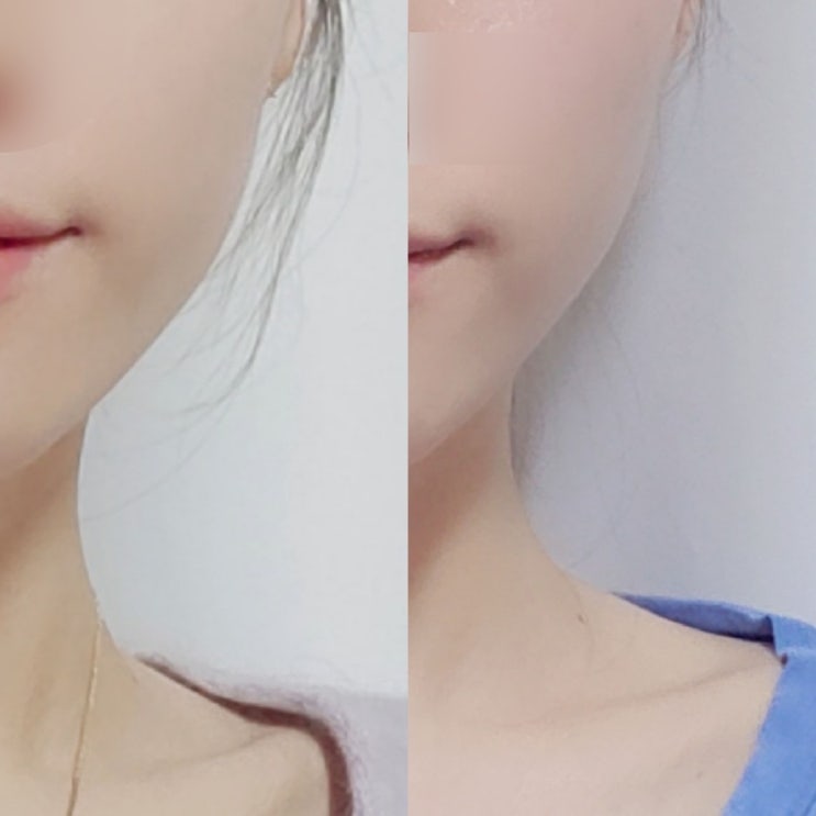  수원피부관리 솔직후기