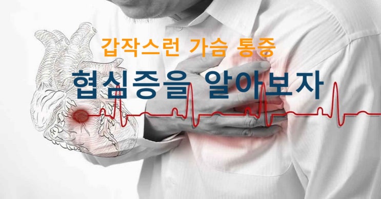  협심증_ 청심환으로 안심하지 마세요
