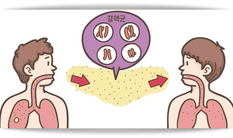  결핵 초기 증상 및 전염, 결핵에 좋은 음식, 예방접종