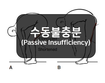  근육의 수동불충분(Passive Insufficiency)!!