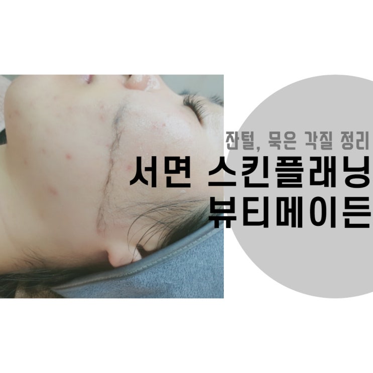  서면스킨플래닝 뷰티메이든, 묵은 각질과 잔털 정리로 매끈한 피부 만들기