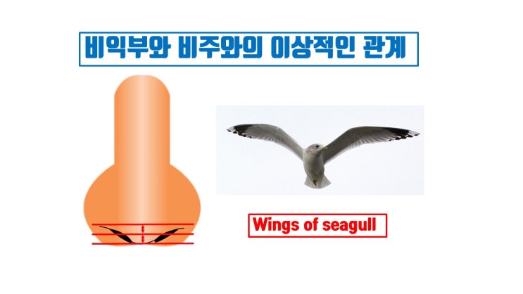  짧은 코 성형을 해도 절대로 콧구멍을 안 보이게 할 수 없는 이유 두 가지
