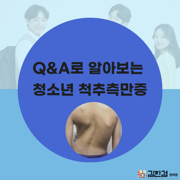  Q&A로 알아보는 청소년 척추측만증, 한의원 치료방법