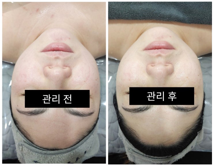  안전한 개인 키트사용, 피부관리실 도민 최대 40% 할인 쿠폰 정보! (서귀포 강정동)