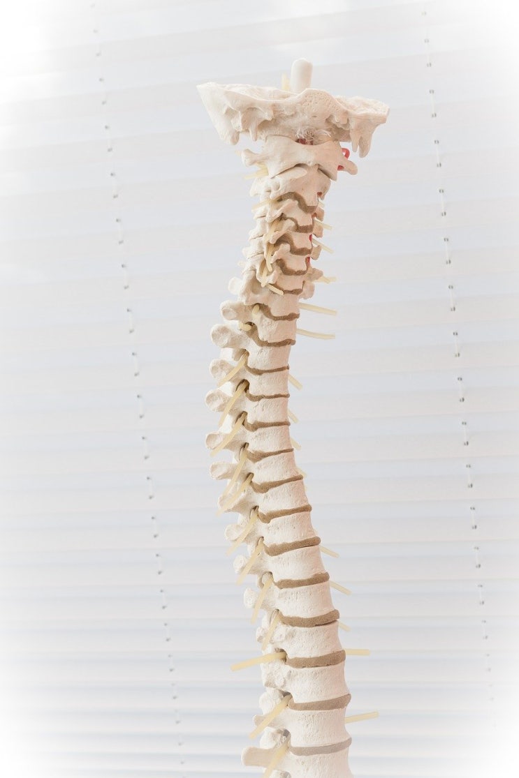 미추(꼬리뼈) 골절로 32.7도 후만변형은 '골반뼈에 뚜렷한 기형을 남긴 때'에 해당하지 않는지 여부
