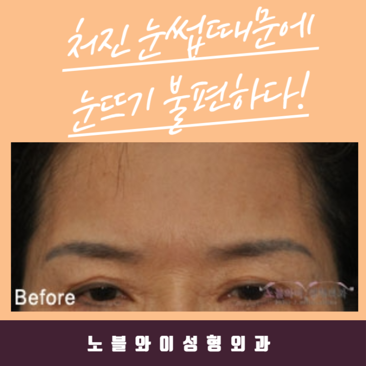  이마거상술잘하는병원 여기만한 곳이 있을까