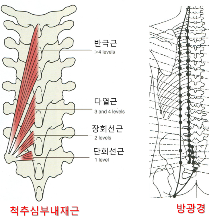  요통, 허리 디스크 치료에서 척추내재근과 방광경이 중요한 이유 - 가로세로 한의원 일산점