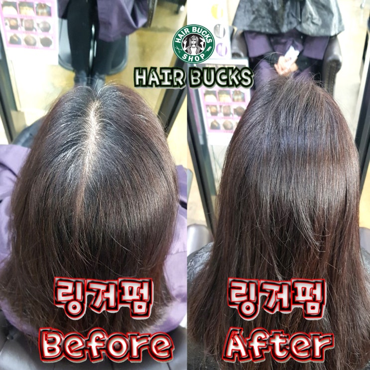  가르마교정 모류교정 정말 신기하네~!