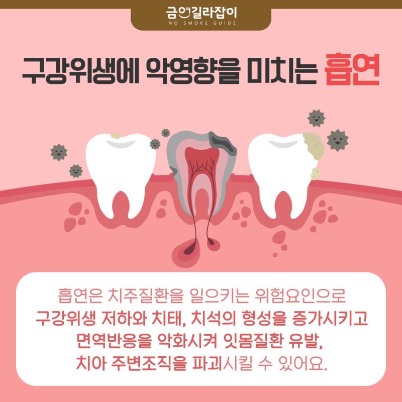 흡연으로 잇몸에 피가 나요? 정발산금연지정클리닉