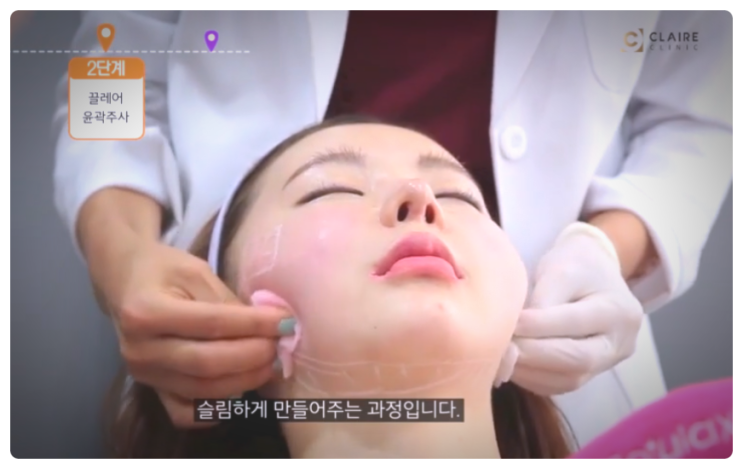  얼굴 작아지는 시술, 연예인이 받았다고 무조건 믿지 마세요