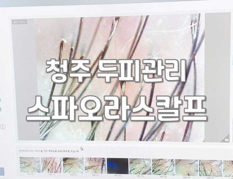  청주 두피관리 전문샵 스파오라스칼프에서 두피케어 받았어요