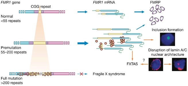 [임신 일기]18주 3일, 기형아 검사/취약 X증후군의 결과 확인, 성별 확인(반전!), 19주 5일 저온 검사