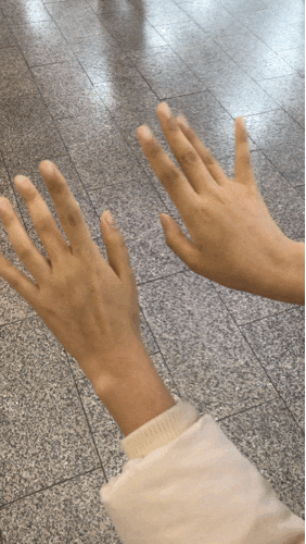  림프부종 약물치료 (1)
