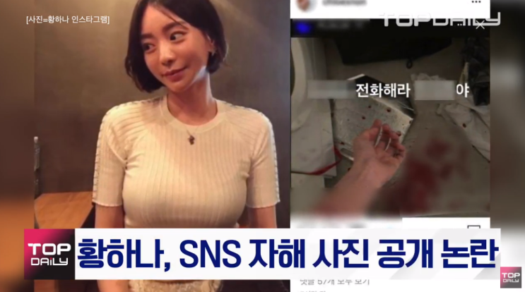 남양유업 황하나 인스타그램 자해 외제차 도난 주장