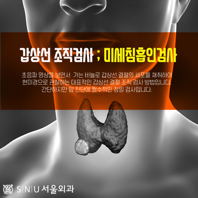 유방결절 유방외과 조직검사리뷰(ft.강동구 SNU서울외과전문의) 9