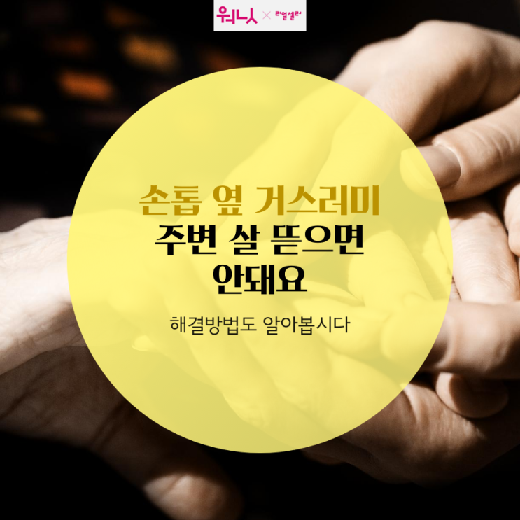  손톱 옆 거스러미 주변 살 뜯으면 안돼요! 해결방법